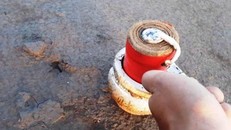 Vỡ bụng, mất cả bàn tay do pháo nổ 