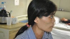 Một phụ nữ nguy kịch vì tự ý uống thuốc chữa bướu cổ