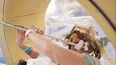 Bà Anna Henry thổi sáo trong khi đang được phẫu thuật kích thích não sâu