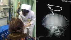 Người phụ nữ thoát chết trong gang tấc sau khi bị kéo rơi trúng đầu