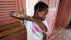  Bùng phát nạn dịch loét ‘ăn thịt người’ lây lan ở Australia