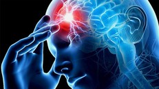 Phương pháp điều trị tiềm năng cho chứng mất trí và đột quỵ