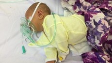 Bé Phún Văn L nhập viện trong tình trạng tím tái, sức khỏe yếu. Ảnh: Bệnh viện cung cấp
