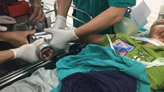 Bé Hoàng nhập viện trong tình trạng bàn tay bị máy xay thịt nghiền nát. Ảnh: Tùng Chi.