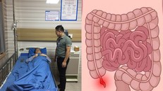 Viêm ruột thừa nhưng chủ quan không đến viện sớm, bệnh nhân này suýt chút nữa phải trả giá bằng tính mạng của mình.