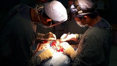 Các bác sỹ Bệnh viện Nhi đồng 2 phẫu thuật tạo hình hộp sọ bị biến dạng cho bệnh nhi. Ảnh: TTXVN phát