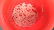 Sán xơ mít dài 9m trong bụng bệnh nhân nam