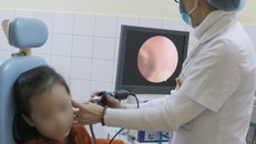 Bé gái 5 tuổi bị hạt cườm rơi vào tai. Ảnh: BVCC.