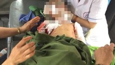 Sau khi bị chó cắn, cháu bé được đưa vào viện cấp cứu nhưng không qua khỏi