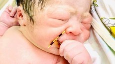 Bé sơ sinh cầm vòng tránh thai. 