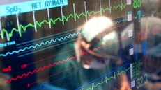 Những dấu hiệu bất thường báo trước cơn đột quỵ