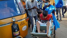 Một bệnh nhi được đưa tới bệnh viện ở Eluru. Ảnh: AP