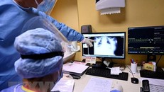 Tác động của COVID-19 đối với chức năng phổi của người trẻ