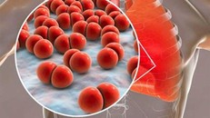 Cuba nghiên cứu phát triển vaccine chống phế cầu khuẩn