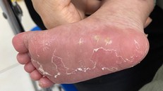 Số trẻ sơ sinh ở Nhật Bản bị bệnh giang mai cao đáng báo động