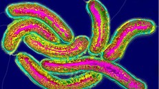 WHO cảnh báo nguy cơ dịch tả lây lan cao tại Liban