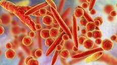 WHO bác thông tin về virus lạ ở Nga