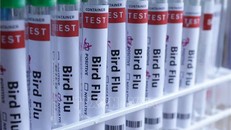 Nga cảnh báo dịch cúm A tiếp tục gia tăng