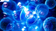 Bệnh nhân Parkinson phục hồi thần kỳ trong 3 tháng nhờ liệu pháp tế bào gốc