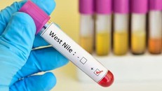 Dịch virus Tây sông Nile lan rộng tại Italy