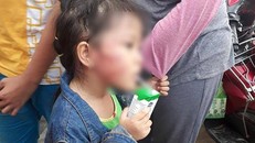 Bé Chi bị đánh nứt xương hàm. (Ảnh: zing.vn)
