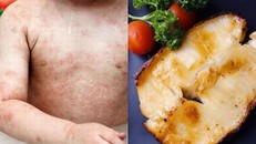 Cậu bé 11 tuổi tử vong vì căn bệnh triệu người mắc nhưng ít để ý