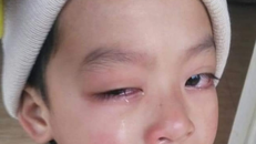 Đình chỉ giáo viên bị tố dùng thước kẻ đánh học sinh lớp 1 đến hỏng mắt