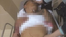 Nạn nhân được đưa đến bệnh viện cấp cứu.