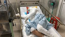 Truy tìm ôtô tông xe ba bánh bốc cháy rồi bỏ trốn khi chủ xe bỏng nặng