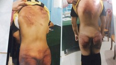 Vụ thầy tu đánh dã man bé 11 tuổi: Trưng cầu giám định thương tật