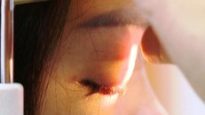 Mù mắt do tiêm filler tại hàng… sửa móng tay