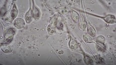 Henneguya salminicola dưới kính hiển vi. (Nguồn: https: timesofisrael.com)