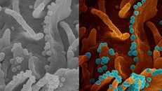 Kính hiển vi chụp ảnh tế bào sắp chết giải phóng các hạt virus mới. - Ảnh: NIH.