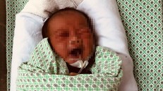 Bé sơ sinh bị bỏ rơi 3 ngày giữa trời nắng 40 độ tổn thương mắt, tai