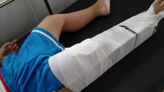 Tạm đình chỉ cô giáo làm bé 3 tuổi gãy xương đùi trong lớp