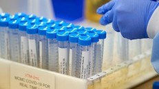 Biến chủng mới của SARS-CoV-2 tại Pháp có thể 'qua mặt' xét nghiệm PCR