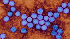 WHO: Phát hiện virus bại liệt trong mẫu nước thải ở London (Anh)