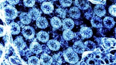 Hình ảnh từ kính hiển vi virus SARS-CoV-2 trong mẫu bệnh phẩm của bệnh nhân mắc COVID-19. (Ảnh: AFP)