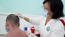 Nhiều trường hợp nhập viện do sử dụng thuốc chữa vảy nến trên mạng