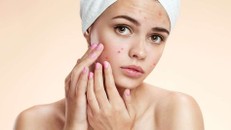 Nghiên cứu thành công vắc-xin trị mụn trứng cá