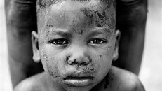 Rùng mình hủ tục rạch mặt trẻ em đánh dấu tuổi trưởng thành ở Tây Phi