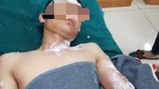 Quảng Bình: Nhiều người nhập viện cấp cứu do đốt pháo trái phép
