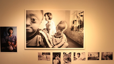 Hình ảnh nạn nhân chất độc màu da cam/dioxin tại Việt Nam.