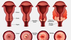 Ảnh minh họa. Nguồn: singingriverhealthsystem