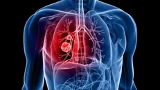 Nguồn: Getty images