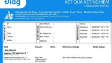Mẫu giấy PCR của Diag. 