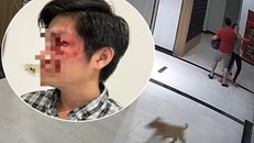 Ông Nguyễn Hoàng Dũng (ảnh nhỏ) và hình ảnh bị chủ nuôi chó đánh ở sảnh chờ thang máy của chung cư Saigon Riverside. 