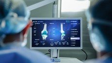 Phần mềm chuyên dụng của Robot CUVIS-Joint giúp bác sĩ kiểm tra và cân bằng tối ưu cấu trúc khớp, mô mềm và trục chi trong quá trình mổ. Ảnh: Bệnh viện Đa khoa Tâm Anh