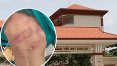 Trường Tiểu học Bình An và học sinh lớp 1 bị bạn đánh (ảnh nhỏ).