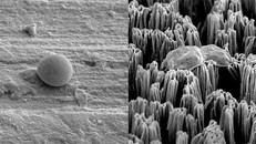 Một tế bào Candida nguyên vẹn trên bề mặt titan đánh bóng (trái) và một tế bào Candida bị vỡ trên bề mặt titan có gai siêu nhỏ (phải). Nguồn: RMIT.